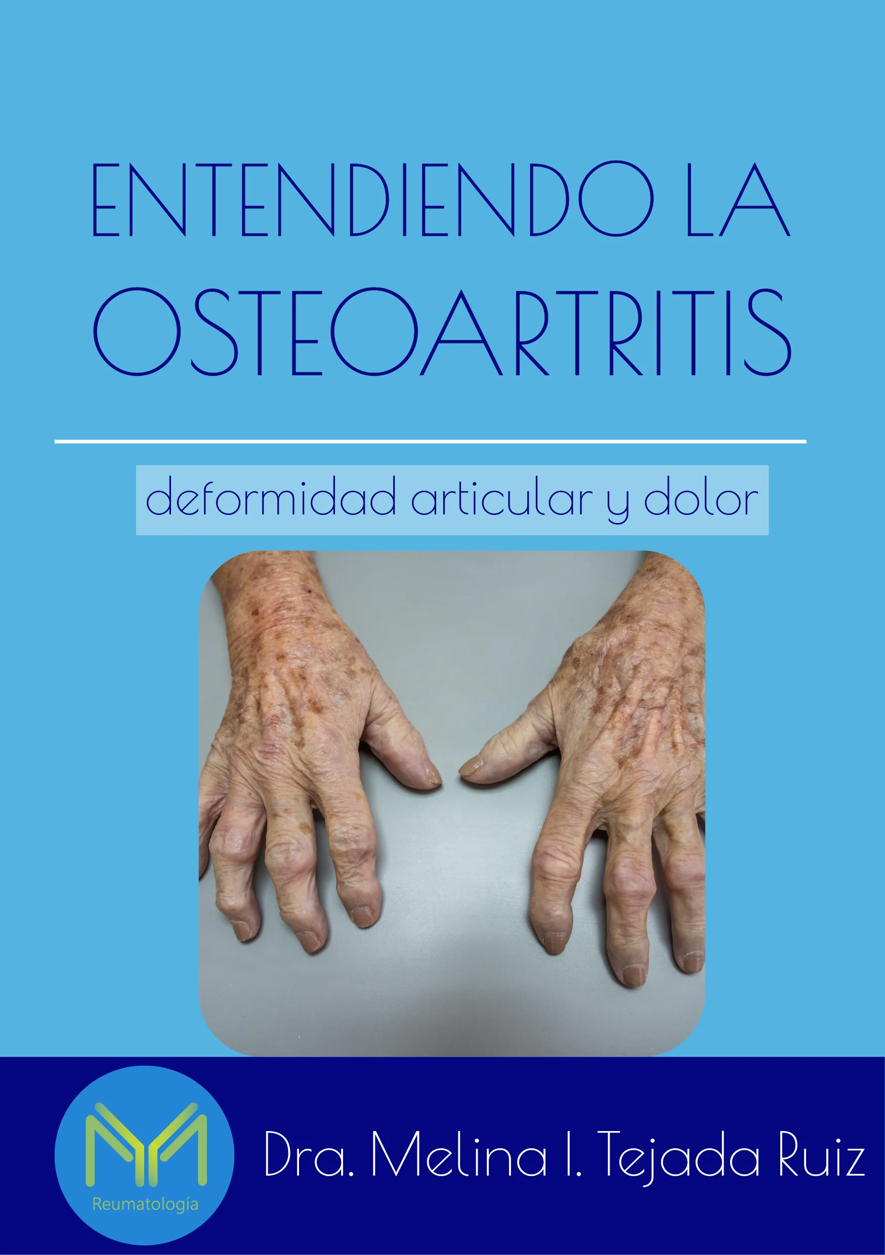 Osteoartritis
